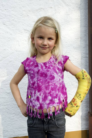 Porträt eines Mädchens mit gebrochenem Arm, lizenzfreies Stockfoto