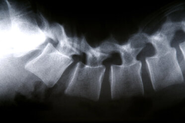 X-ray, close-up - PMF00547