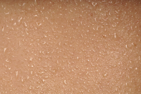 Human skin with sweat, full frame, close-up - CRF01486