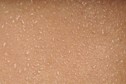 Menschliche Haut mit Schweiß, Vollbild, Nahaufnahme - CRF01486
