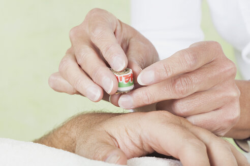 Therapeutin bereitet Akupunktur-Moxa-Therapie an der Hand eines Mannes vor - GWF001425