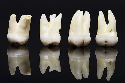 Row of wisdom tooth against black background - MUF001076