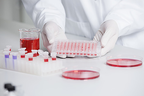 Deutschland, Bayern, München, Wissenschaftlerin hält rote Flüssigkeit in Testschale für medizinische Forschung im Labor - RBF000809