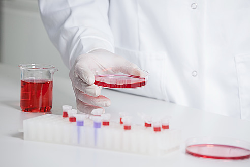 Deutschland, Bayern, München, Wissenschaftlerin hält rote Flüssigkeit in Petrischale für medizinische Forschung im Labor - RBF000849