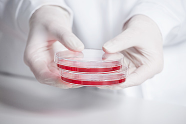 Germany, Bavaria, Munich, Scientist holding red liquid in petri dish for medical research in laboratory - RBF000851