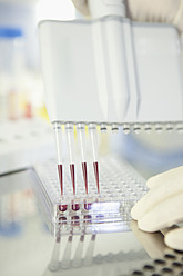Deutschland, Bayern, München, Wissenschaftlerin untersucht Blut im Labor - RBF001029