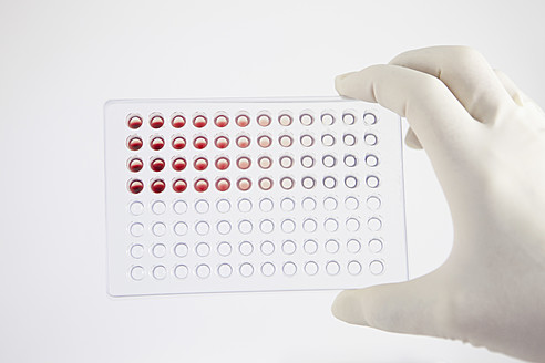 Deutschland, Bayern, München, Wissenschaftlerin untersucht Blut im Labor - RBF001025