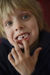 Austria, Boy showing tooth gap, close up - CWF000036