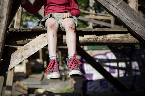 Germany, North Rhine Westphalia, Cologne, Boy injured in playground stock photo