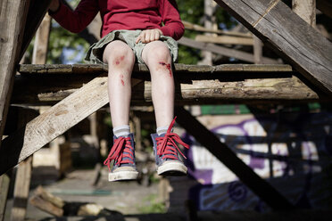 Germany, North Rhine Westphalia, Cologne, Boy injured in playground - FMKYF000420