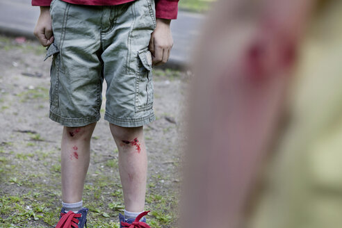 Germany, North Rhine Westphalia, Cologne, Boys injured in playground - FMKYF000421