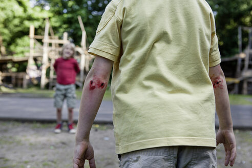 Deutschland, Nordrhein-Westfalen, Köln, Jungen auf Spielplatz verletzt - FMKYF000435