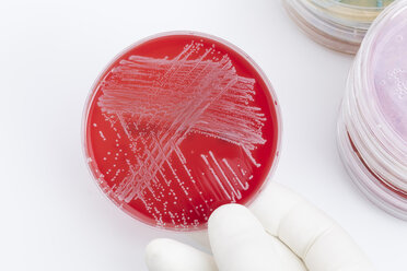 Human hand holding petri dish with bacteria, close up - DRF000004