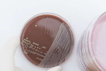 Human hand holding petri dish with bacteria, close up - DRF000006