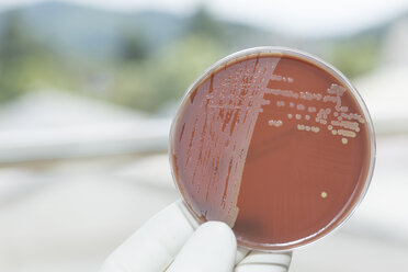 Germany, Freiburg, Human hand holding petri dish with bacteria, close up - DRF000010