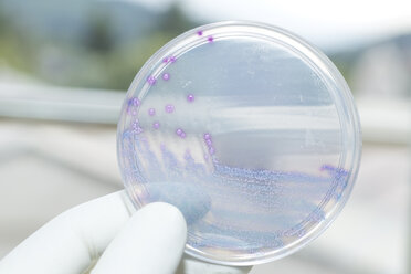 Germany, Freiburg, Human hand holding petri dish with bacteria, close up - DRF000012