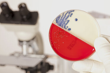 Germany, Freiburg, Young woman holding petri dish with bacteria - DRF000070