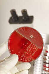 Germany, Freiburg, Young woman holding petri dish with bacteria - DRF000071