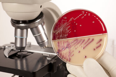 Germany, Freiburg, Young woman holding petri dish with bacteria - DRF000073