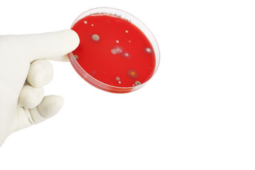 Junge Frau hält Petrischale mit Bakterien - DRF000075