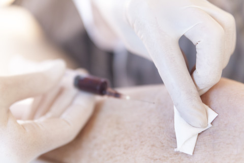 Heilpraktikerin tupft Blut nach einer Blutentnahme ab, lizenzfreies Stockfoto