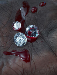Handfläche mit drei Diamanten und Blut, Nahaufnahme - AK000329