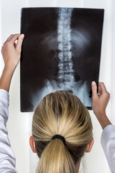 Doctor looking at x-ray of spine - EJWF000451