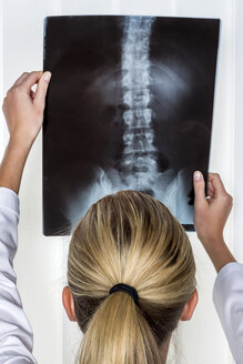 Arzt betrachtet Röntgenbild der Wirbelsäule - EJWF000451