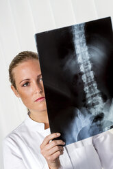 Doctor looking at x-ray of spine - EJWF000463