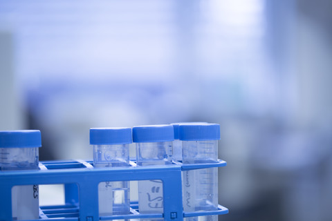 Gefäße mit Flüssigkeiten in einem Labor, lizenzfreies Stockfoto