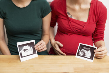 Pregnant woman and friend showing ultrasound scans - MIDF000022