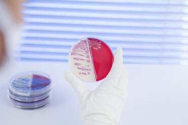 Laborant bei der Untersuchung einer Agarplatte mit Bakterien - DR001550