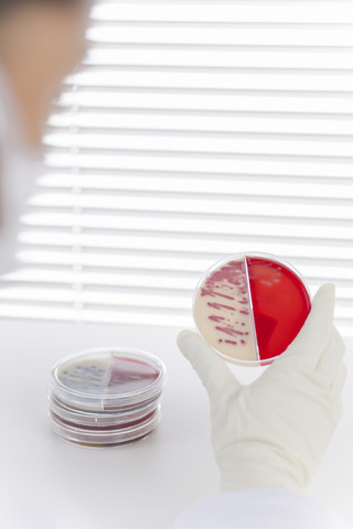 Laboratory technician examining agar plate with bacteria stock photo