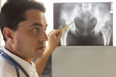 Doctor pointing at x-ray of a pelvis - BZF000093