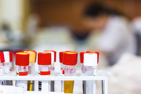 Blood samples in test tube rack - DISF001653