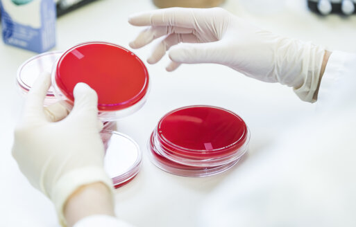 Close-up of lab technician working with agar plates - DISF001584