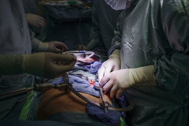 Surgeons transplanting a kidney - MWE000018