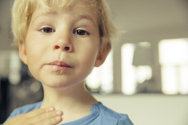 Portrait of little boy having sore throat - MFF001661