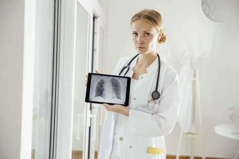 Porträt einer ernsten Ärztin, die eine Röntgenaufnahme auf einem digitalen Tablet zeigt - MFF001828