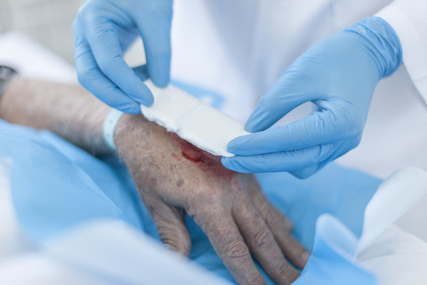 Krankenschwester beim Verbinden einer Wunde an der Hand eines Patienten, lizenzfreies Stockfoto