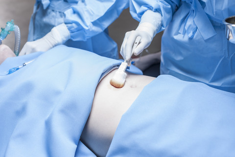 Preparation for a surgery stock photo