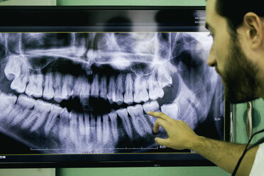 Zahnarzt zeigt ein Röntgenbild - ABZF000135