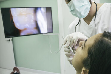 Dentist examining the mouth of a patient with an intraoral camera - ABZF000137