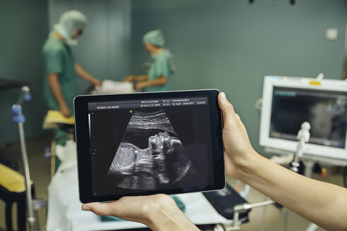 Hands holding a digital tablet showing an ultrasound image of a fetus in surgery room - MFF002337