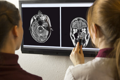 Doctor and patient looking at MRI image - MIDF000711