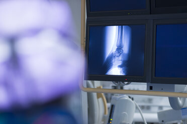 Radiologe beim Betrachten eines Röntgenbildes - MWEF000026