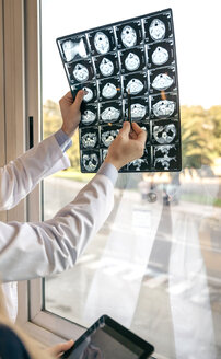 Zwei Ärzte besprechen einen MRT-Scan am Fenster - DAPF000074