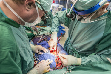 Chirurgen, die eine Bypass-Operation am Herzen durchführen - MWEF000030