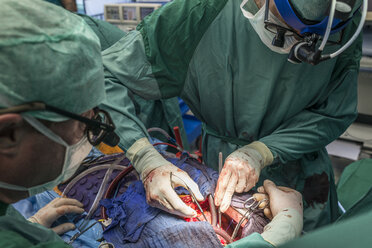 Surgeons executing heart bypass surgery - MWEF000034