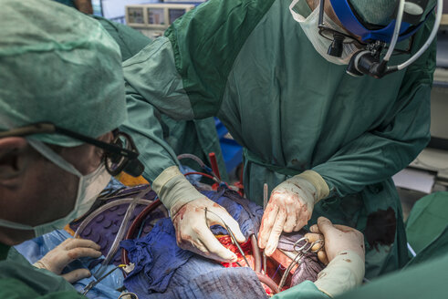 Chirurgen, die eine Bypass-Operation am Herzen durchführen - MWEF000034